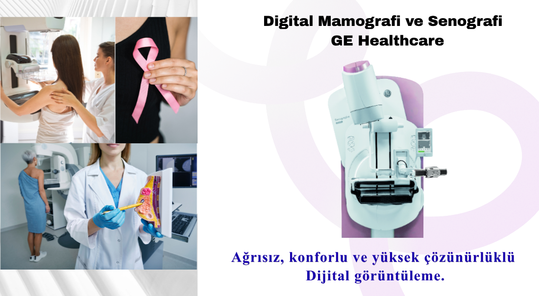 Mamografi
