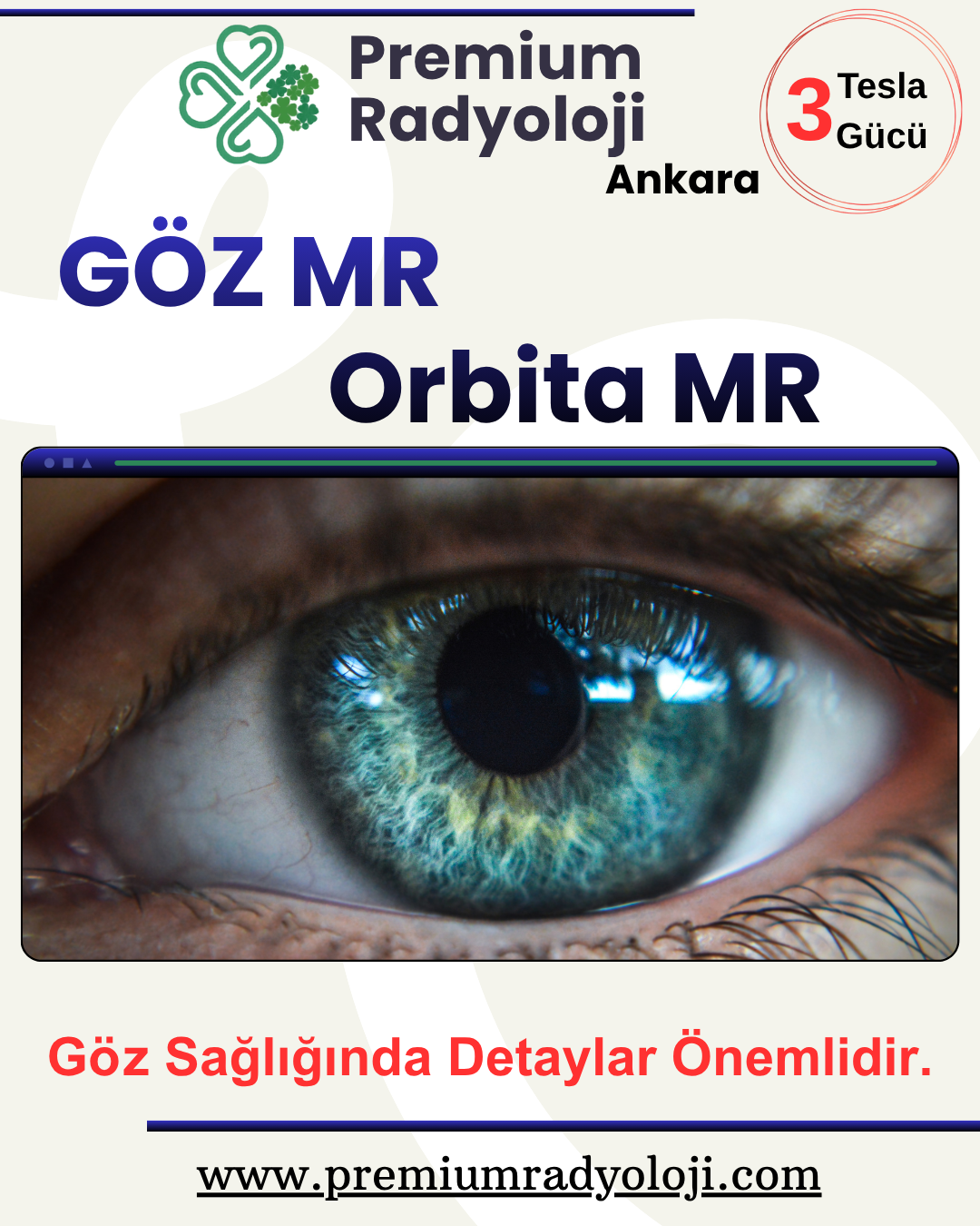 Göz MR (Orbita MR) Nedir? Nasıl Çekilir?